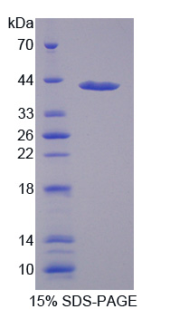 Recombinant Methylenetetrahydrofolate Reductase (MTHFR)