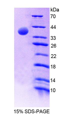 Recombinant Mitochondrial Methionyl tRNA Formyltransferase (MTFMT)