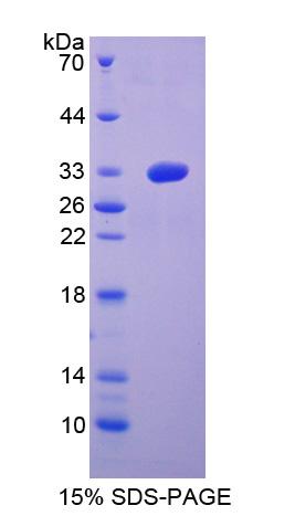 Recombinant Meteorin (METRN)