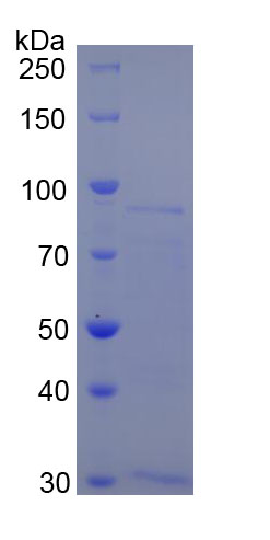 Recombinant Methionyl Aminopeptidase 2 (METAP2)