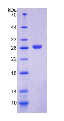 Recombinant Malic Enzyme 2, NADP+ Dependent, Mitochondrial (ME2)