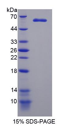 Recombinant Microtubule Associated Serine/Threonine Kinase 2 (MAST2)