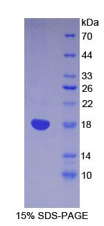 Recombinant Lymphocyte Antigen 96 (LY96)