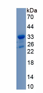 Recombinant Leucine Rich Repeat Kinase 2 (LRRK2)