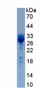 Recombinant Lymphocyte Adaptor Protein (Lnk)