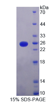 Recombinant V-Ki-Ras2 Kirsten Rat Sarcoma Viral Oncogene Homolog (KRAS)