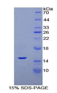 Recombinant Klotho Beta (KLb)