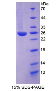 Recombinant Inter Alpha-Globulin Inhibitor H3 (ITIH3)