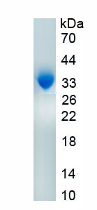 Recombinant Inter Alpha-Globulin Inhibitor H2 (ITIH2)