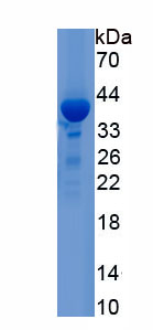 Recombinant Inter Alpha-Globulin Inhibitor H1 (ITIH1)