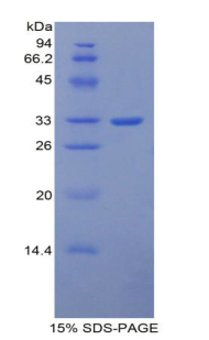 Recombinant Inter Alpha-Globulin Inhibitor H1 (ITIH1)