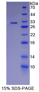 Recombinant Iron Responsive Element Binding Protein 2 (IREB2)