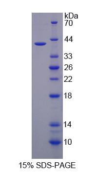 Recombinant Iron Responsive Element Binding Protein 2 (IREB2)