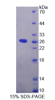 Recombinant Interleukin 1 Receptor Accessory Protein Like Protein 2 (IL1RAPL2)