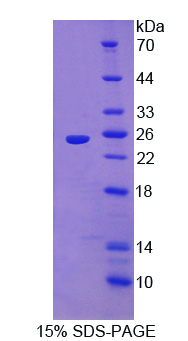 Recombinant Interleukin 1 Receptor Accessory Protein Like Protein 1 (IL1RAPL1)