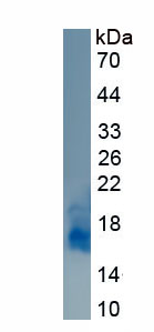 Recombinant Interleukin 1 Receptor Accessory Protein (IL1RAP)