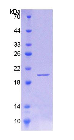 Recombinant Interleukin 18 Binding Protein (IL18BP)