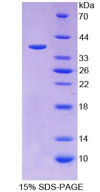 Recombinant Iduronidase Alpha L (IDUa)