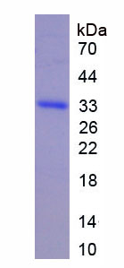 Recombinant Iduronate-2-Sulfatase (IDS)
