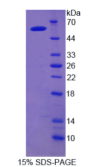 Recombinant Iduronate-2-Sulfatase (IDS)