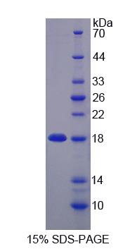 Recombinant Zinc Ribbon Domain Containing Protein 1 (ZNRD1)