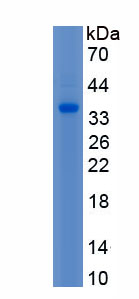 Recombinant Homeobox Protein B4 (HOXB4)