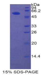 Recombinant Hepatocyte Growth Factor Activator (HGFAC)