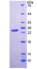 Recombinant Hepatitis A Virus Cellular Receptor 2 (HAVCR2)