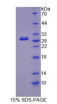 Recombinant Guanylate Cyclase 1 Beta 3 (GUCY1b3)