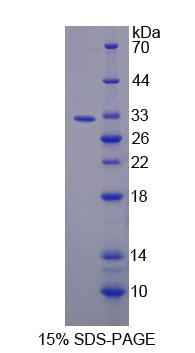 Recombinant Glycerol-3-Phosphate Acyltransferase, Mitochondrial (GPAM)