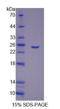 Recombinant Growth Factor, Augmenter Of Liver Regeneration (GFER)