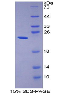 Recombinant Gastrokine 2 (GKN2)