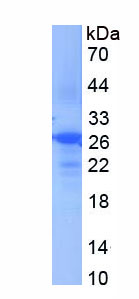 Recombinant Gastrokine 2 (GKN2)