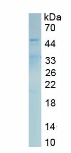 Recombinant Galactose-1-Phosphate Uridylyltransferase (GALT)