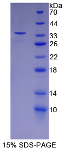 Recombinant Follistatin Like Protein 1 (FSTL1)