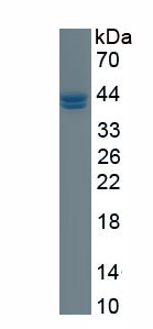 Recombinant Fragile X Mental Retardation 1 (FMR1)