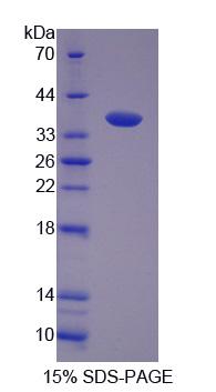 Recombinant F-Box And Leucine Rich Repeat Protein 3 (FBXL3)