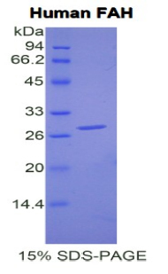 Recombinant Fumarylacetoacetate Hydrolase (FAH)
