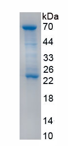 Recombinant Electron Transferring Flavoprotein Dehydrogenase (ETFDH)