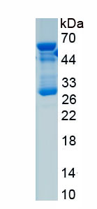 Recombinant Eosinophil Peroxidase (EPX)