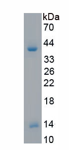 Recombinant Dynein, Axonemal, Heavy Chain 11 (DNAH11)