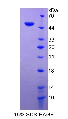 Recombinant Destrin (DSTN)