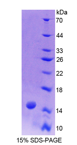 Recombinant Biglycan (BGN)