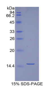 Recombinant Biglycan (BGN)