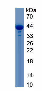 Recombinant Dihydroorotate Dehydrogenase (DHODH)
