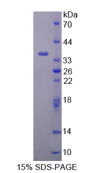 Recombinant Dual Adaptor Of Phosphotyrosine And 3-Phosphoinositides (DAPP1)
