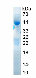 Recombinant Di-N-Acetyl Chitobiase (CTBS)