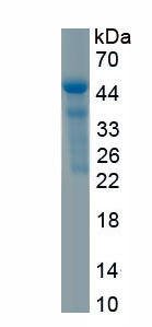 Recombinant Cancer/Testis Antigen 1B (CTAG1B)