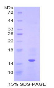 Recombinant Cystatin B (CSTB)