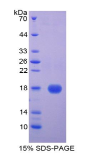 Recombinant Cystatin 5 (CST5)